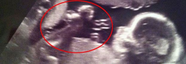 LA GIOVANE MAMMA RIGUARDA LA SUA ECOGRAFIA DOPO 2 ANNI .E FA UNA INCREDIBILE SCOPERTA