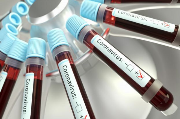 Tampone,Coronavirus