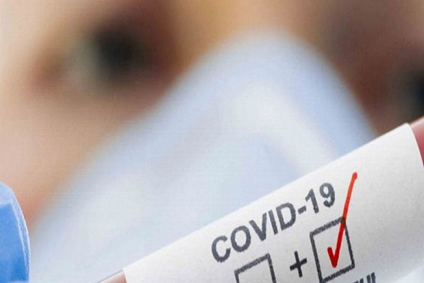 Test Rapidi Covid