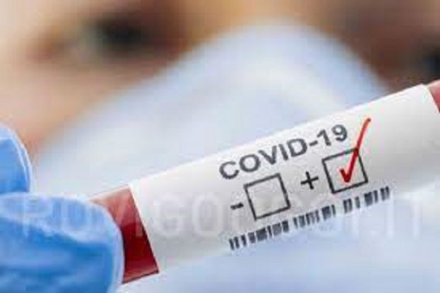 Covi-19 Test